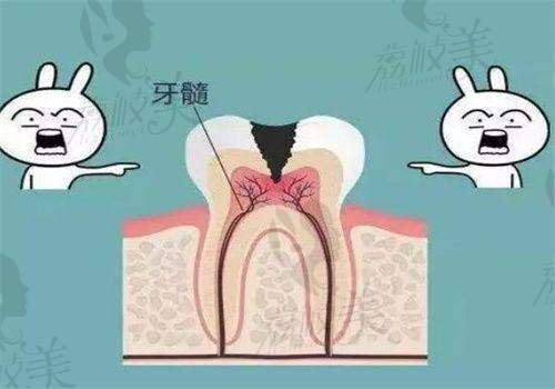 结尾小Tips：如何判断自己是否需要根管治疗？