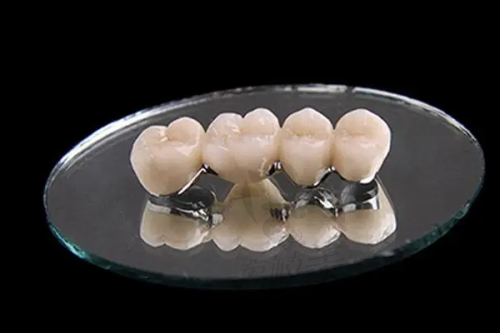 从实地就诊体验来看:中喜的牙冠是否“划算”?