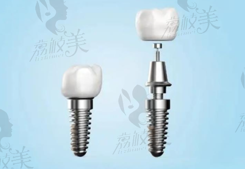 【乌鲁木齐于氏天使口腔门诊部仪器设备有哪些】