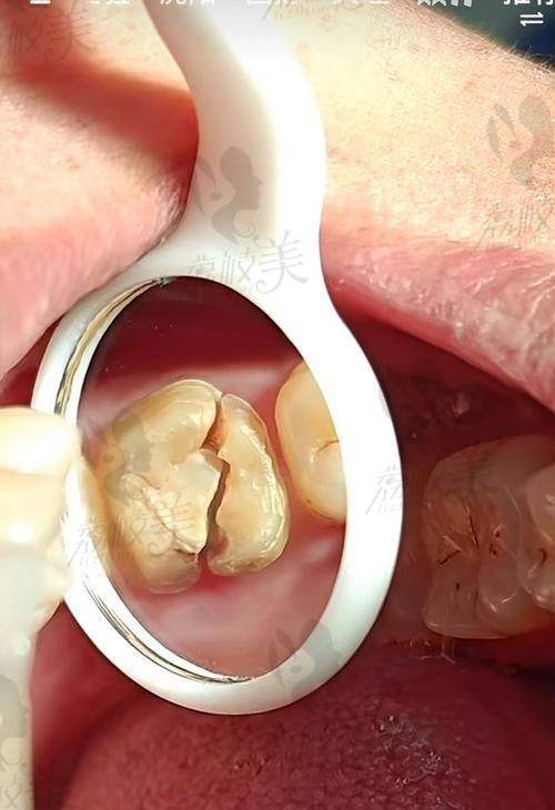 医院简介：盐城中喜口腔，连锁品牌力量加持