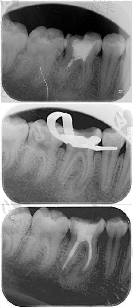 舒适不痛护牙，细致守护“牙”气人生