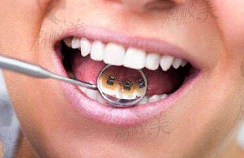 榜单详解与价值点融合