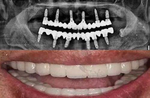 如何根据需求选择适合的抚州牙医?