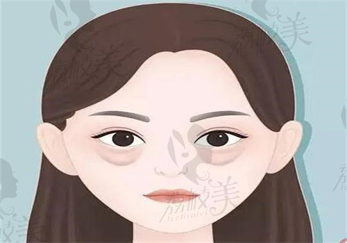 上海爱尚丽格张诗若做眼袋修复18000元起,技术靠谱