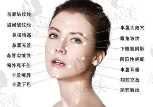 徐凤霞医生擅长项目: