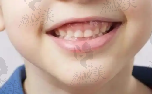 七、东莞桥头普济口腔医院价格表:(仅供参考)