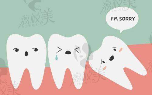 张慧烽医生的技术特点详解