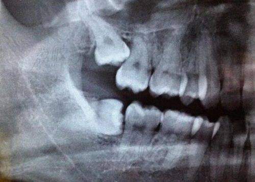 六、榆林市靖边县牙博仕口腔门诊部怎么预约：