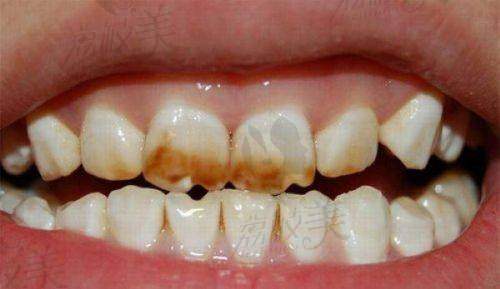 八、东莞桥头普济口腔医院真实的患者评价如下: