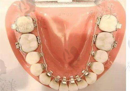 儿童牙科收费标准?