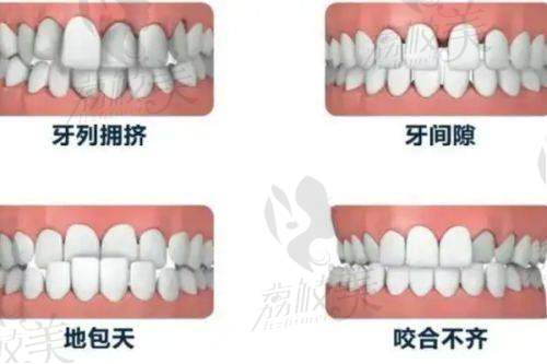 总结:道县看牙,预算就放这!