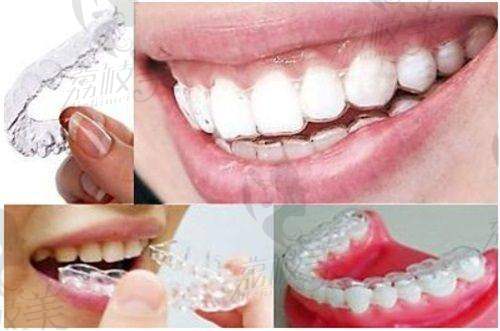 胡熹医生怎么预约挂号?