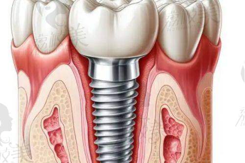 海沧医院牙科挂号与诊疗流程费用分析