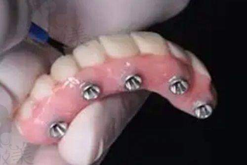 瑞昌百年达口腔门诊怎么预约挂号？