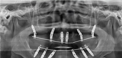 总结:海沧医院牙科收费,透明公开还是优选