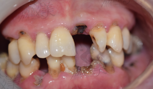 海沧医院牙科收费价目表