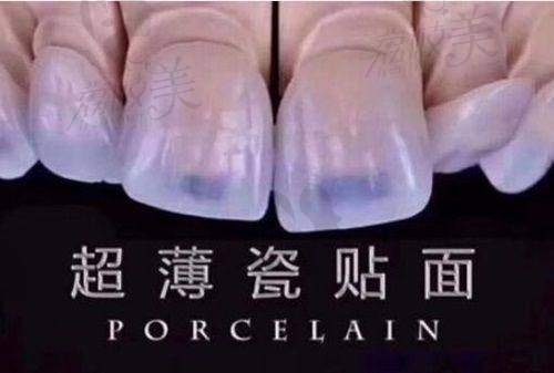 北大口腔任抒欣医生:个性化治疗贴心骨干医生