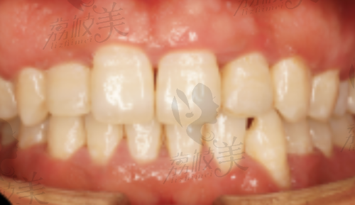 结语:选择张慧烽医生,选择安心、专精与美丽笑容