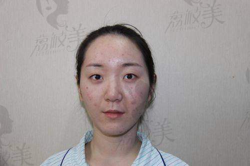 遵义韩美杨栋:1999 元切开双眼皮,价格亲民到离谱!