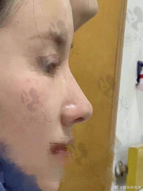 刘绍瑞医生为啥这么火?看完你就懂了