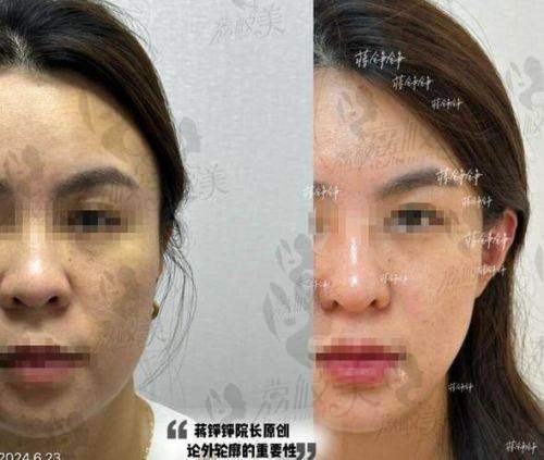 韩国Plans Clinic（普兰斯医院）预约方式详解