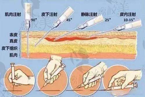 韩国Plans Clinic（普兰斯医院）的技术团队及服务优势