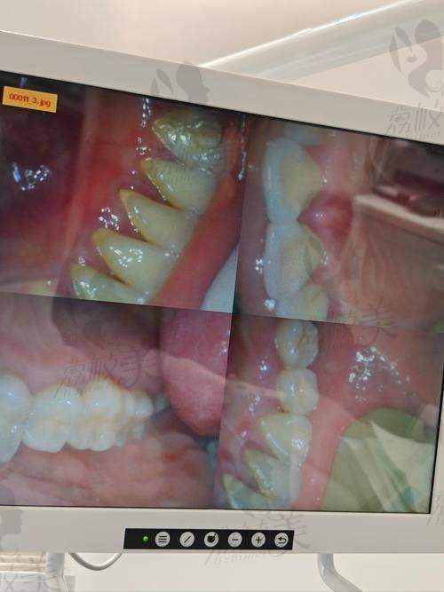 海沧牙科与区内其他机构费用差异对比