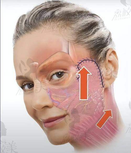 李向东医生——性价比天花板,30岁轻龄群体请看过来!