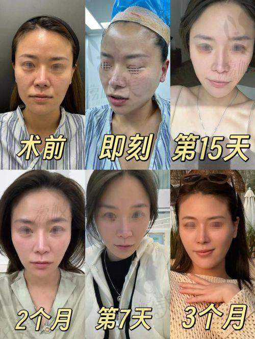 华 西医院整形科筋膜提升骨干医生哪个好?4位医生各有绝活,盘点一目了然!