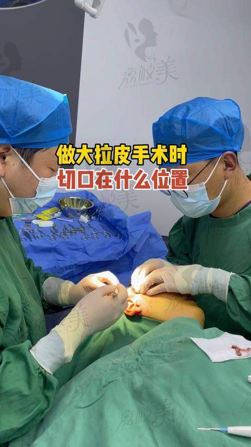 一、杜太超是谁?不是“网红骨干医生”,是真的“技术派”