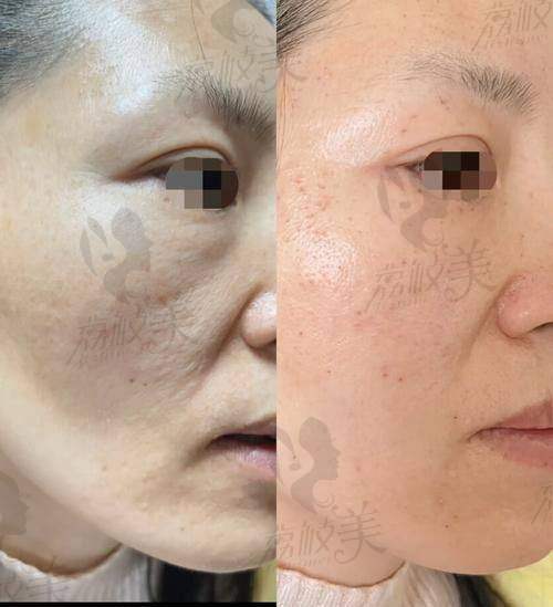 西安市第四 医院皮肤激光治疗中 心地址及乘车路线