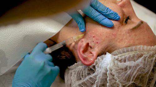 徐凤霞医生技术特点: