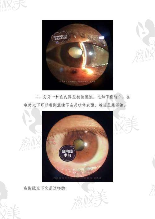 全文总结:记住几点,看艾医生90%稳了!