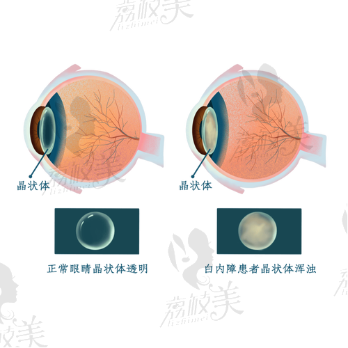 热门手术项目和价格参考:钱包要有点准备哦