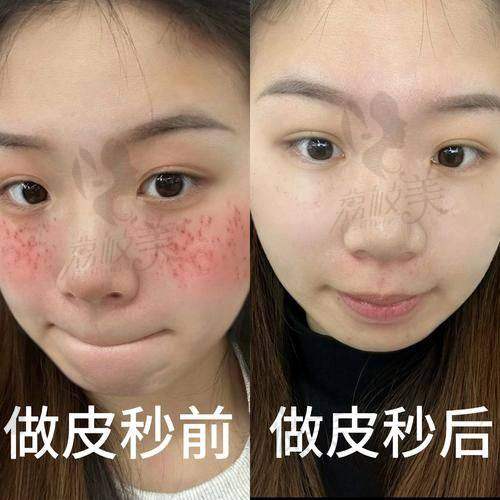 深圳南方门诊激光整形美容中 心特色项目: